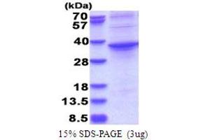 ASPHD1 Protein (AA 96-390) (His tag)