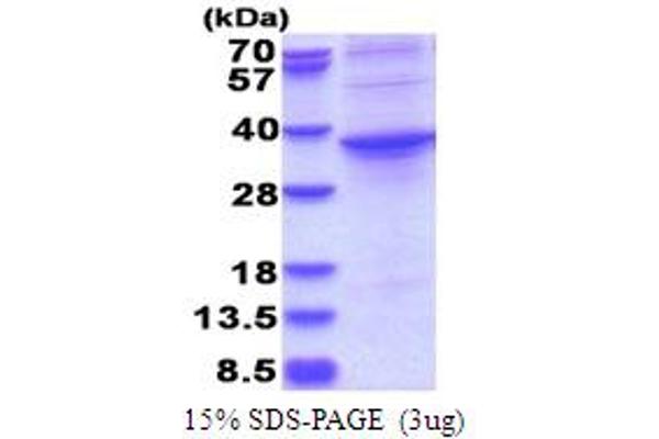 ASPHD1 Protein (AA 96-390) (His tag)