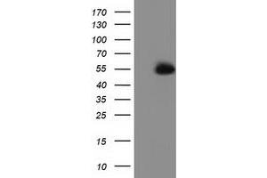 HEK293T cells were transfected with the pCMV6-ENTRY control (Left lane) or pCMV6-ENTRY SNTA1 (Right lane) cDNA for 48 hrs and lysed. (SNTA1 抗体)