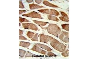 Immunohistochemistry (Paraffin-embedded Sections) (IHC (p)) image for anti-Transgelin (TAGLN) (AA 139-167), (C-Term) antibody (ABIN390627)
