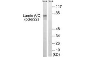 Western blot analysis of extracts from HeLa cells treated with paclitaxel 1uM 24h, using Lamin A (Phospho-Ser22) Antibody. (Lamin A/C 抗体  (pSer22))