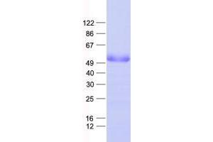 Western Blotting (WB) image for Zinc Finger Protein 101 (ZNF101) protein (His tag) (ABIN2735918)