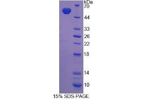 SDS-PAGE analysis of Rat ABCC11 Protein. (ABCC11 蛋白)