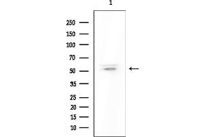 Western blot analysis of lysates from EC304 cells(heat-shock treatment), using OR8S1 Antibody at 1/1000 dilution.