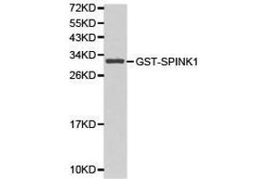 Western Blotting (WB) image for anti-serine Peptidase Inhibitor, Kazal Type 1 (SPINK1) antibody (ABIN1874923) (SPINK1 抗体)