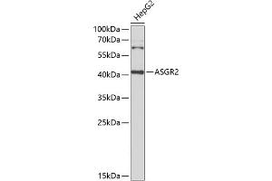 Western blot analysis of extracts of HepG2 cells, using  Antibody (ABIN6127456, ABIN6137183, ABIN6137186 and ABIN6221878) at 1:1000 dilution. (Asialoglycoprotein Receptor 2 抗体  (AA 58-287))