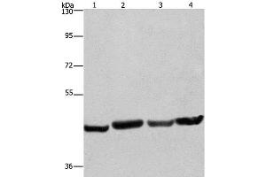 Western Blot analysis of A549, Hela, PC3 and HepG2 cell using RBMY1A1 Polyclonal Antibody at dilution of 1:360 (RBMY1A1 抗体)