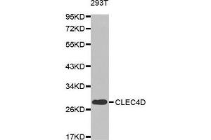 Western blot analysis of extracts of 293T cell line, using CLEC4D antibody. (CLEC4D 抗体  (AA 39-215))
