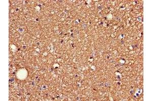 Immunohistochemistry (IHC) image for anti-Syndecan 4 (SDC4) (AA 19-145) antibody (ABIN7171195)