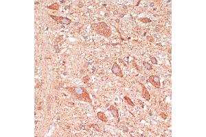 Immunohistochemistry of paraffin-embedded rat brain using G antibody (ABIN7267516) at dilution of 1:100 (40x lens). (GAP43 抗体  (AA 1-238))