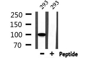 Western Blotting (WB) image for anti-General Transcription Factor IIIC, Polypeptide 2, beta 110kDa (GTF3C2) (N-Term) antibody (ABIN6257244)