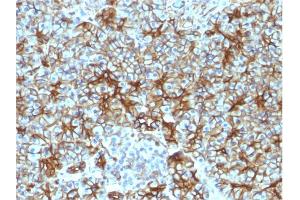 Formalin-fixed, paraffin-embedded human Pancreas stained with Spectrin beta III Monoclonal Antibody (SPTBN2/1583). (Spectrin, Beta, Non-erythrocytic 2 (SPTBN2) (AA 356-475) 抗体)