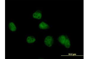 Immunofluorescence of purified MaxPab antibody to COPS8 on HeLa cell. (COPS8 抗体  (AA 1-209))