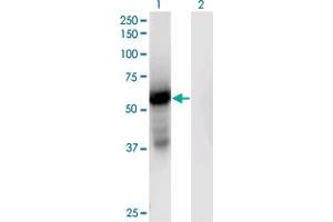 Western Blot analysis of GPT2 expression in transfected 293T cell line by GPT2 monoclonal antibody (M04), clone 7A11. (GPT2 抗体  (AA 358-456))