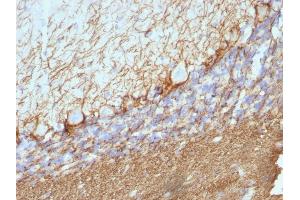 Immunohistochemistry (IHC) image for anti-Neurofilament, Heavy Polypeptide (NEFH) antibody (ABIN6940184)
