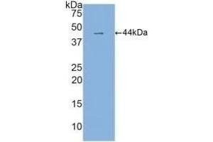 Detection of Recombinant IL6, Human using Monoclonal Antibody to Interleukin 6 (IL6) (IL-6 抗体  (AA 30-212))