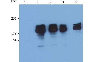 Western Blotting analysis (reducing conditions) of human SHIP-1 in whole cell lysate of THP-1 human acute monocytic leukemia cell line. (INPP5D 抗体  (N-Term))