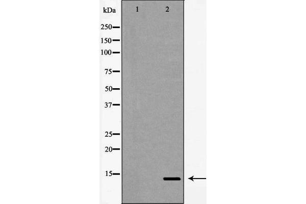 beta Synuclein 抗体  (C-Term)