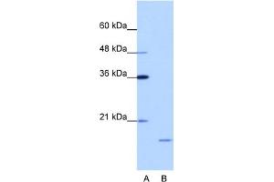 WB Suggested Anti-ISG20 Antibody Titration:  1. (ISG20 抗体  (N-Term))