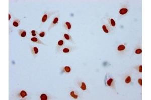 Immunocytochemistry analysis of ABIN7139609 diluted at 1:10 and staining in Hela cells performed on a Leica BondTM system. (HIST1H2AG 抗体  (meLys9))