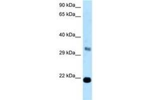 Image no. 1 for anti-FK506 Binding Protein 14, 22 KDa (FKBP14) (C-Term) antibody (ABIN6747894) (FKBP14 抗体  (C-Term))