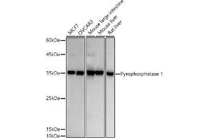 Western blot analysis of extracts of various cell lines, using Pyrophosphatase 1 antibody (ABIN7269762) at 1:500 dilution.