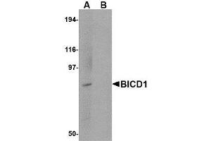 Image no. 1 for anti-Bicaudal D Homolog 1 (BICD1) (C-Term) antibody (ABIN1492179)
