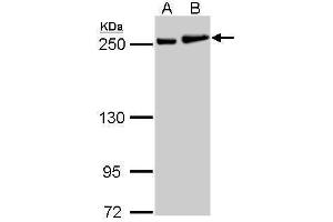 WB Image MYH9 antibody [N1], N-term detects MYH9 protein by Western blot analysis.
