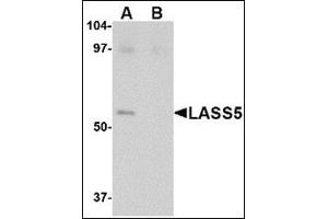 Western blot analysis of LASS5 in SK-N-SH lysate with this product at 1 μg/ml in the (A) absence and (B) presence of blocking peptide. (LASS5 抗体  (C-Term))