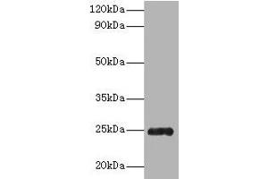 Western blot All lanes: Trypsin antibody at 2 μg/mL + Recombinant Pig Trypsin protein 1 μg Secondary Goat polyclonal to rabbit IgG at 1/10000 dilution Predicted band size: 25 kDa Observed band size: 25 kDa (Trypsin 抗体  (AA 9-231))