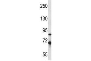 Irak1 antibody western blot analysis in mouse Neuro-2a lysate. (IRAK1 抗体  (AA 405-433))