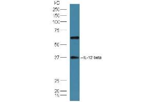 IL12B 抗体  (AA 201-300)