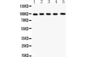 Western blot analysis of ASPH using anti-ASPH antibody (ABIN3043790).