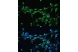 Immunofluorescence analysis of NIH-3T3 cells using Casein Kinase 2 beta (Casein Kinase 2 beta (CSNK2B)) Polyclonal Antibody (ABIN7266104) at dilution of 1:100 (40x lens). (CSNK2B 抗体  (AA 1-215))