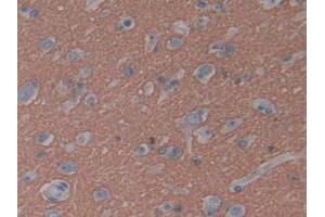 Immunohistochemistry (IHC) image for anti-Growth Associated Protein 43 (GAP43) (AA 1-274) antibody (ABIN7433477)