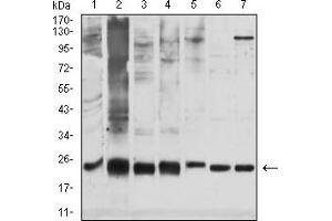 Western Blotting (WB) image for anti-Glutathione S-Transferase pi 1 (GSTP1) (AA 2-210) antibody (ABIN7193605)
