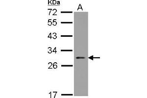 Western Blotting (WB) image for anti-Nucleolar Protein 3 (Apoptosis Repressor with CARD Domain) (NOL3) (AA 1-197) antibody (ABIN1501899) (NOL3 抗体  (AA 1-197))