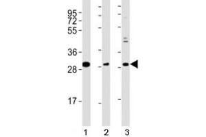 Western blot testing of Nkx2. (NK2 Homeobox 5 抗体  (AA 98-133))
