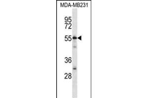 CABIN486182 and ABIN1535563 Antibody (N-term) (ABIN657088 and ABIN2837891) western blot analysis in MDA-M cell line lysates (35 μg/lane). (C7ORF25 抗体  (N-Term))