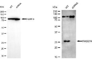Western blotting analysis using RAB27A antibody (ABIN7800092).
