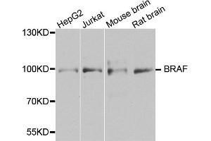 Western blot analysis of extracts of various cell lines, using BRAF antibody. (BRAF 抗体)