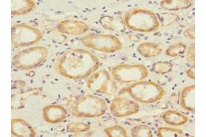 Immunohistochemistry of paraffin-embedded human kidney tissue using ABIN7166096 at dilution of 1:100 (SAV1 抗体  (AA 1-210))