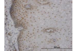 Immunoperoxidase of monoclonal antibody to MBNL1 on formalin-fixed paraffin-embedded human esophagus. (MBNL1 抗体  (AA 1-382))