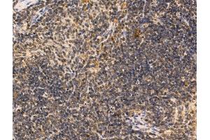 ABIN6259960 and ABIN6268870 at 1/100 staining Mouse spleen tissue by IHC-P.