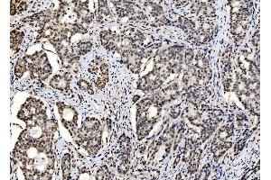 IHC analysis of DBC-1/CCAR2 using anti-DBC-1/CCAR2 antibody (ABIN7602235). (CCAR2 抗体  (AA 65-917))