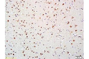 Formalin-fixed and paraffin embedded human brain labeled with Anti-HDAC10 Polyclonal Antibody, Unconjugated (ABIN681298) at 1:200 followed by conjugation to the secondary antibody and DAB staining (HDAC10 抗体  (AA 561-669))
