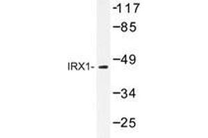 Western blot analysis of IRX1 antibody in extracts from LOVO cells. (IRX1 抗体)