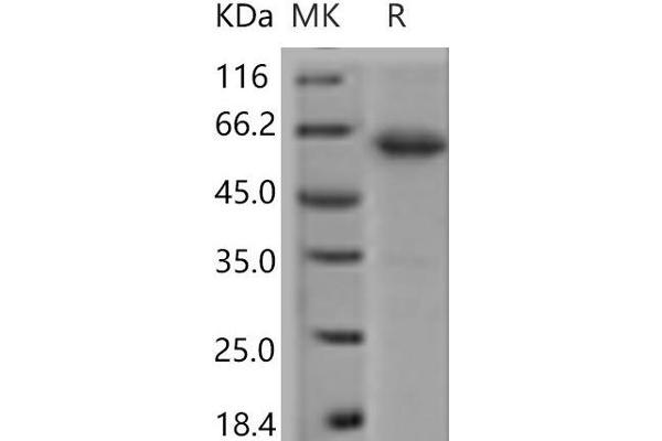 JAM2 Protein (Fc Tag)
