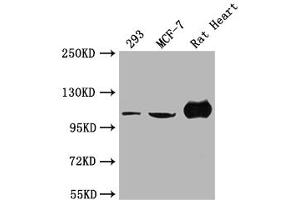 Western Blot Positive WB detected in: 293 whole cell lysate, MCF-7 whole cell lysate, Rat Heart tissue All lanes: ACTN2 antibody at 1:2000 Secondary Goat polyclonal to rabbit IgG at 1/50000 dilution Predicted band size: 104 kDa Observed band size: 104 kDa (ACTN2 抗体  (AA 1-301))