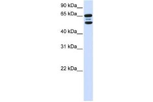 Western Blotting (WB) image for anti-F-Box Protein 21 (FBXO21) antibody (ABIN2458715) (FBXO21 抗体)